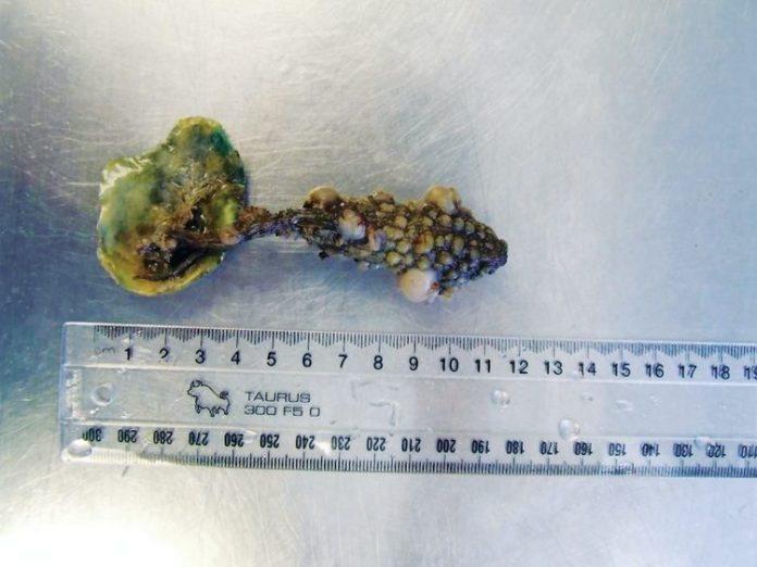 Styela clava can also hitchhike on commercially harvested shellfish. If shells carrying the pest are discarded back into the sea or left on beaches, it can establish in new locations.